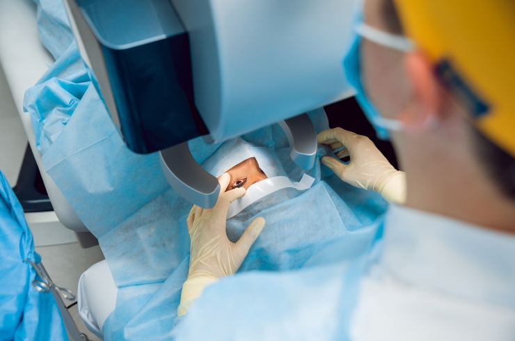 Cataract Surge